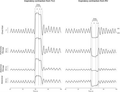 After-Effects of Thixotropic Maneuvers on Chest Wall and Compartmental Operational Volumes of Healthy Subjects Using Optoelectronic Plethysmography